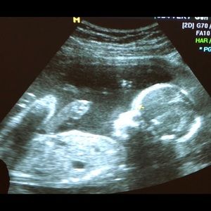 Meet your Posher, Mia